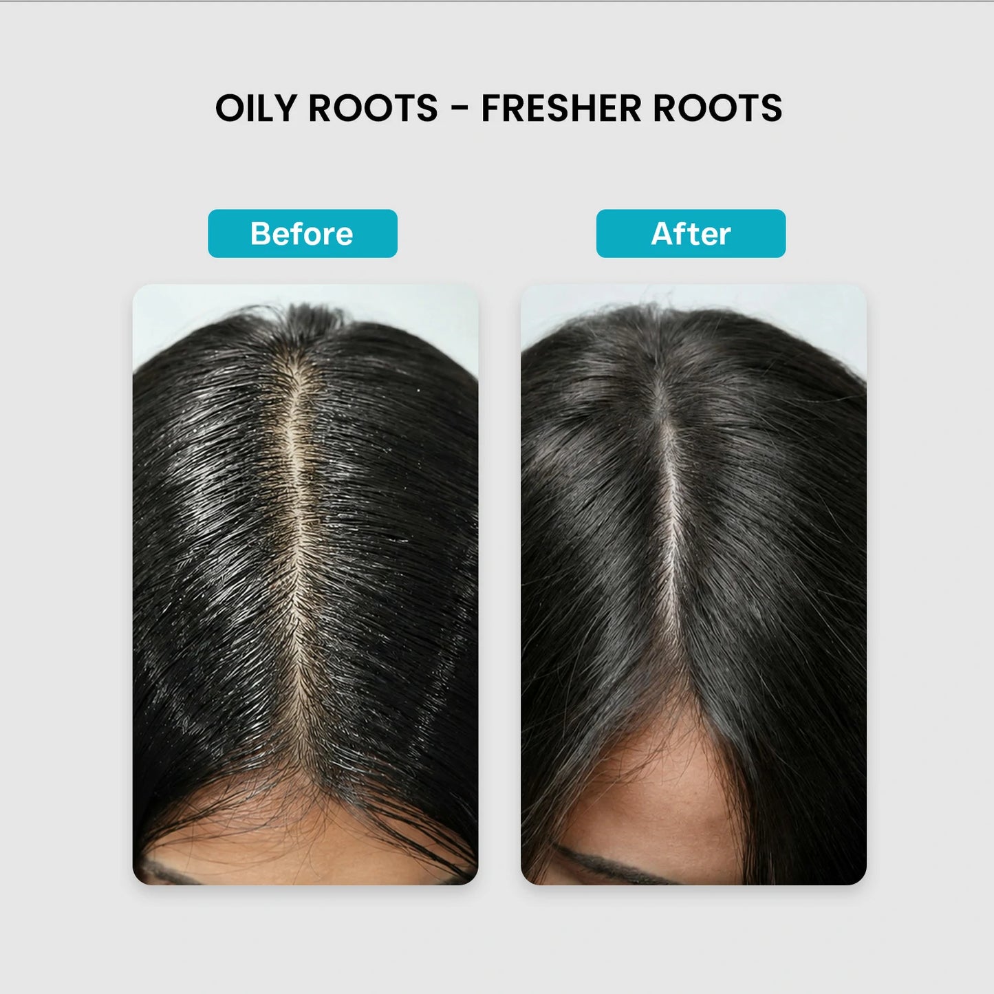 Scalp Defense Shampoo (For Oily Scalp)
