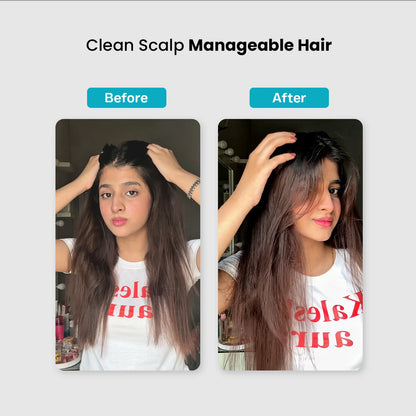 Scalp Defense Shampoo