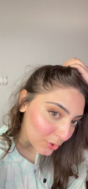 Nurel Mist Transformation After