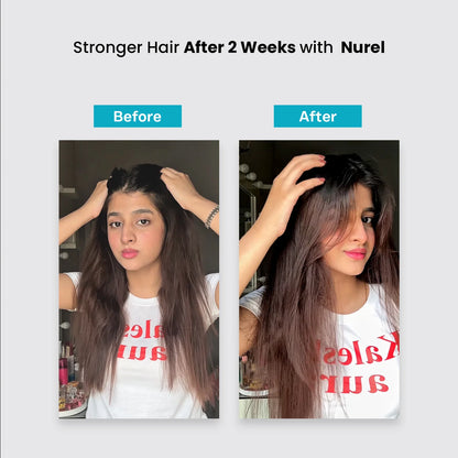 Scalp Defense Shampoo